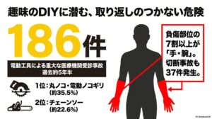 趣味のDIYに潜む取り返しのつかない危険。電動工具による重大な医療機関受診事故は過去約5年半で186件。負傷部位の7割以上が手・腕。